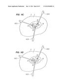 METHOD FOR ABLATING TISSUE WITH MULTIPLE ABLATION PROBES diagram and image