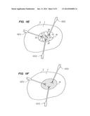 METHOD FOR ABLATING TISSUE WITH MULTIPLE ABLATION PROBES diagram and image