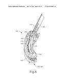 SURGICAL INSTRUMENT HAVING KNIFE BAND WITH CURVED DISTAL EDGE diagram and image