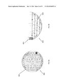 METHOD, APPARATUS, AND A SYSTEM FOR ROBOTIC ASSISTED CATARACT SURGERY diagram and image