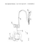 METHOD, APPARATUS, AND A SYSTEM FOR ROBOTIC ASSISTED CATARACT SURGERY diagram and image