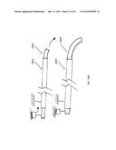 METHOD, APPARATUS, AND A SYSTEM FOR ROBOTIC ASSISTED CATARACT SURGERY diagram and image