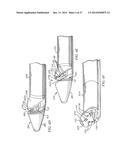 Minimally Invasive Repair of a Valve Leaflet in a Beating Heart diagram and image