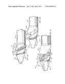 Minimally Invasive Repair of a Valve Leaflet in a Beating Heart diagram and image