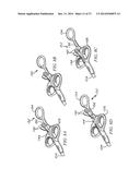 Minimally Invasive Repair of a Valve Leaflet in a Beating Heart diagram and image