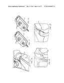 Minimally Invasive Repair of a Valve Leaflet in a Beating Heart diagram and image