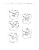 Minimally Invasive Repair of a Valve Leaflet in a Beating Heart diagram and image