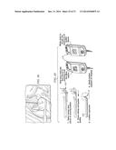 Minimally Invasive Repair of a Valve Leaflet in a Beating Heart diagram and image