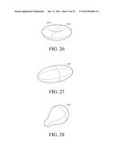 INTRAGASTRIC DEVICE diagram and image