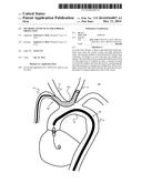 Methods And Devices For Embolic Protection diagram and image