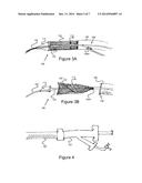 Methods And Devices For Embolic Protection diagram and image