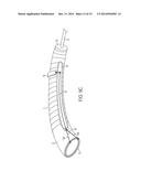 Pericardial Devices, Systems and Methods for Occluding an Atrial Appendage diagram and image