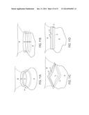 Pericardial Devices, Systems and Methods for Occluding an Atrial Appendage diagram and image