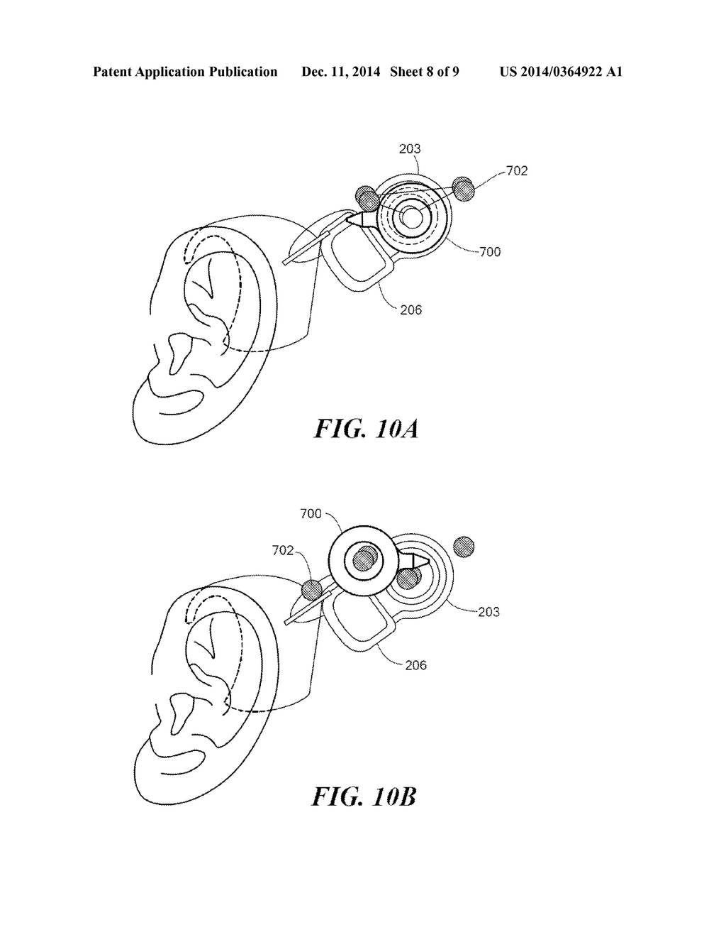 Vestibular Implant System with Internal and External Motion Sensors - diagram, schematic, and image 09