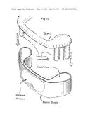 THERAPEUTIC EYE AND EYELID COVER diagram and image