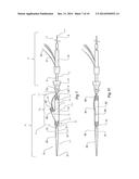 INTRODUCER FOR AN ILIAC SIDE BRANCH DEVICE diagram and image