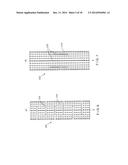 Graft Collection and Containment System for Bone Defects diagram and image