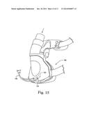 VENTLESS MASK CPAP SYSTEM diagram and image