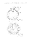 MASK VENT diagram and image