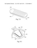 MASK VENT diagram and image