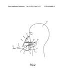 PATIENT INTERFACE DEVICE FIXABLE TO THE PATIENT VIA A BONE ANCHOR INSIDE     THE PATIENT S MOUTH diagram and image