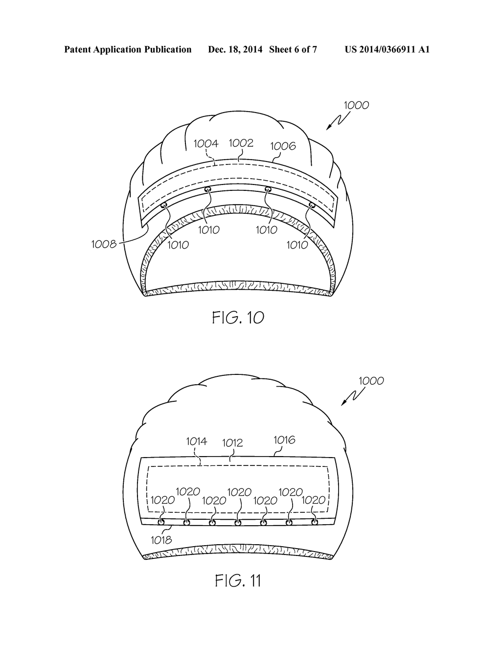 HEAD COVER HAVING SELECTABLE SIZE AND LOCATION OF OPENING FOR EXPOSURE OF     A PORTION OF A USER'S HAIR - diagram, schematic, and image 07