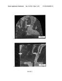 METHOD OF CLADDING AND FUSION WELDING OF SUPERALLOYS diagram and image