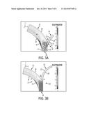 HDS CHANNEL EXIT DESIGNS FOR IMPROVED SEPARATION EFFICIENCY diagram and image