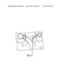 HDS CHANNEL EXIT DESIGNS FOR IMPROVED SEPARATION EFFICIENCY diagram and image