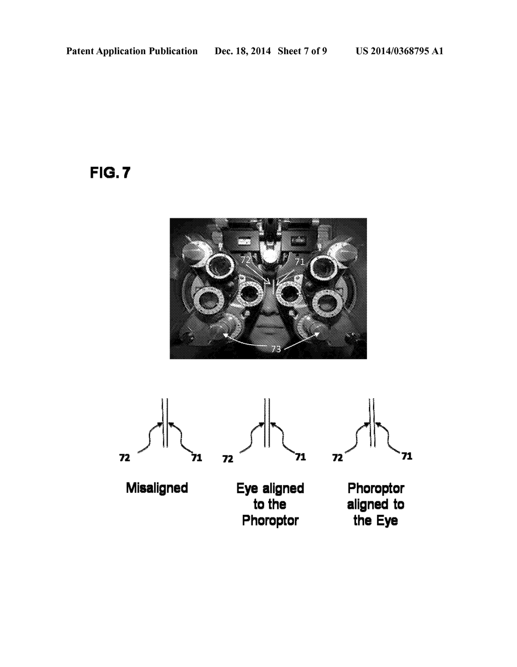 Methods And Devices For Refractive Correction Of Eyes - diagram, schematic, and image 08