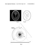 CT IMAGING METHODS AND SYSTEMS diagram and image