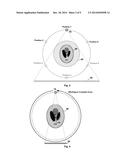 CT IMAGING METHODS AND SYSTEMS diagram and image