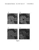 SYSTEMS AND METHODS FOR AUTOMATED ANALYSIS OF CELLS AND TISSUES diagram and image