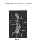 PSMA-BINDING AGENTS AND USES THEREOF diagram and image