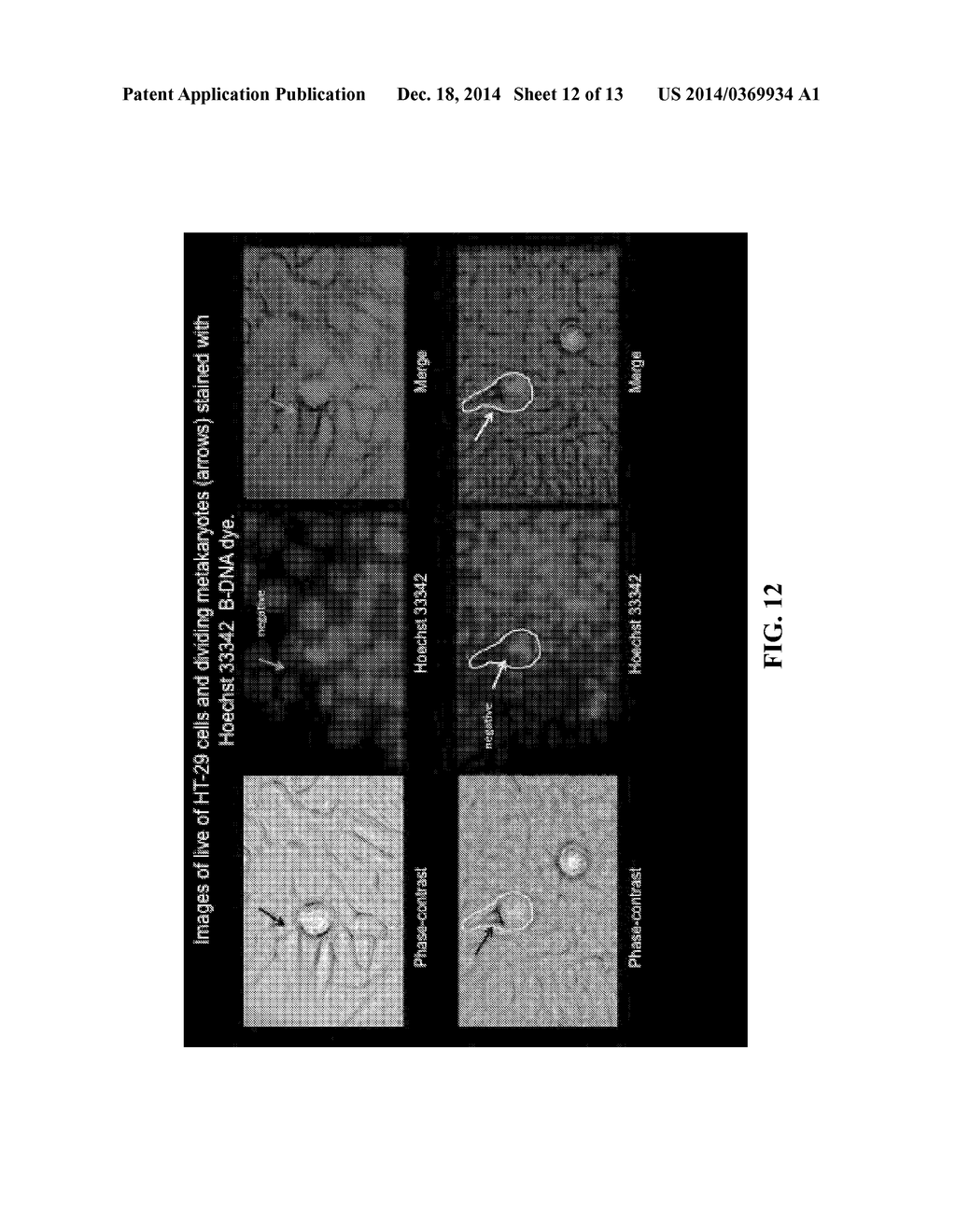 dsRNA/DNA Hybrid Genome Replication Intermediate Of Metakaryotic Stem     Cells - diagram, schematic, and image 13