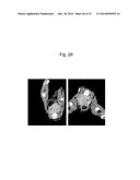 LIPOSOME COMPOSITE BODY diagram and image