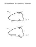 GOLF CLUB HEAD HAVING A STRESS REDUCING FEATURE WITH APERTURE diagram and image