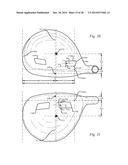 GOLF CLUB HEAD HAVING A STRESS REDUCING FEATURE WITH APERTURE diagram and image