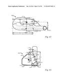 GOLF CLUB HEAD HAVING A STRESS REDUCING FEATURE WITH APERTURE diagram and image