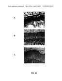 GROWTH HORMONE POLYPEPTIDES AND METHODS OF MAKING AND USING SAME diagram and image