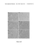 p19Arf, HMGA2 and MDM2 For Use in the Diagnosis and Treatment of Aberrant     Cell Growth diagram and image