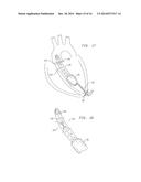 VENTRICULAR ASSIST DEVICE FOR INTRAVENTRICULAR PLACEMENT diagram and image