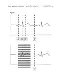 NONCONTACT ELECTROPHYSIOLOGICAL MEASUREMENT AND IMAGING OF THE HEART diagram and image