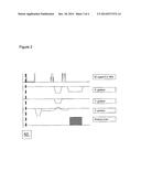 NONCONTACT ELECTROPHYSIOLOGICAL MEASUREMENT AND IMAGING OF THE HEART diagram and image