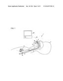 ULTRASOUND MEDICAL APPARATUS AND ULTRASOUND DIAGNOSIS APPARATUS diagram and image