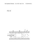 ULTRASOUND MEDICAL APPARATUS AND ULTRASOUND DIAGNOSIS APPARATUS diagram and image