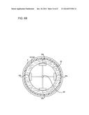 ULTRASOUND MEDICAL APPARATUS AND ULTRASOUND DIAGNOSIS APPARATUS diagram and image