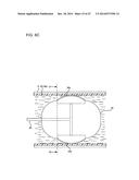 ULTRASOUND MEDICAL APPARATUS AND ULTRASOUND DIAGNOSIS APPARATUS diagram and image