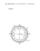 ULTRASOUND MEDICAL APPARATUS AND ULTRASOUND DIAGNOSIS APPARATUS diagram and image