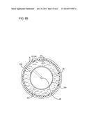 ULTRASOUND MEDICAL APPARATUS AND ULTRASOUND DIAGNOSIS APPARATUS diagram and image